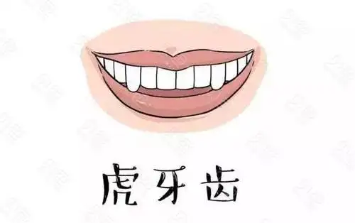 注意虎牙可能潜伏有隐患