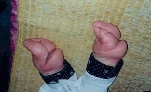 解放前中国妇女脚的图片,好像是缠足的 急需!