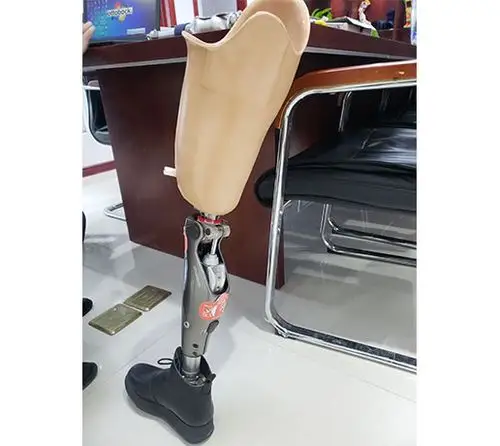 大腿假肢案例