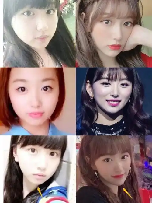 99青春有你二中的孔雪儿,其实在开播之前就有很多人喜_圈子-新氧