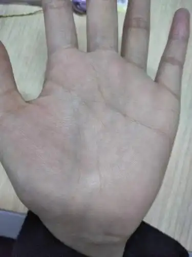 大师们帮我看看我这个手相,没有生命线,智慧线有两条分叉,可能生命线