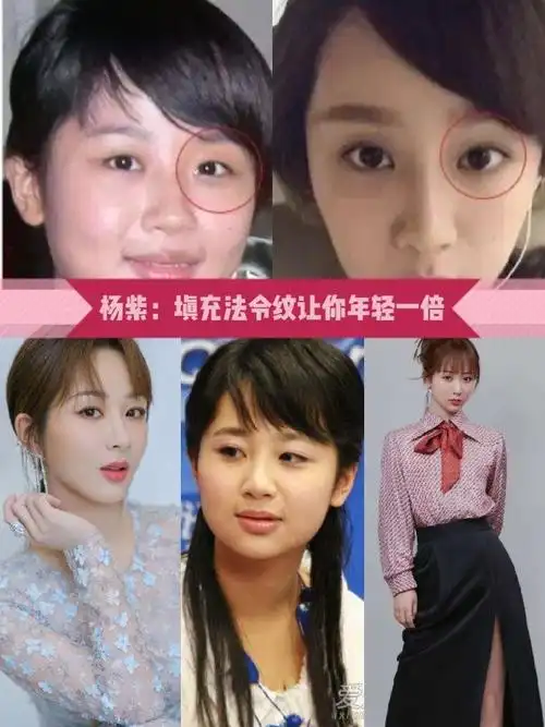 杨紫从童星开始就被受关注,大火之前可是公认的国民女儿,可近期一直被