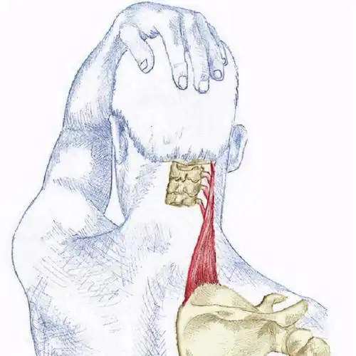 你的下巴能碰到肩膀吗感觉疼痛试试这个动作拉伸肩胛提肌