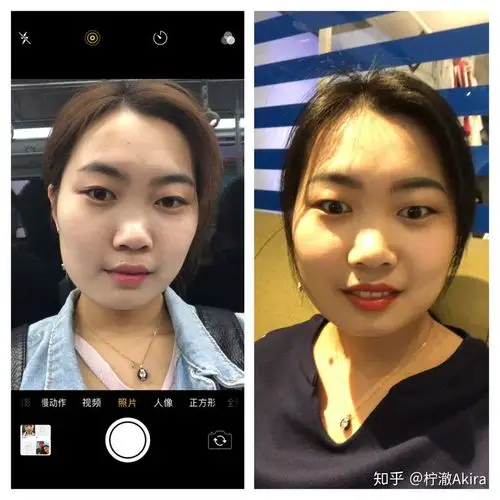 去年暑假到现在长胖了20斤,脸也变胖了,减肥的话,脸会瘦下来吗?