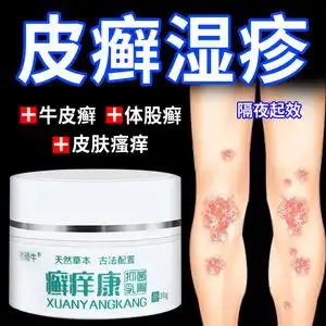 皮肤瘙痒外用药手足藓体股藓真菌感染止痒特效药膏彡倾听同款货源