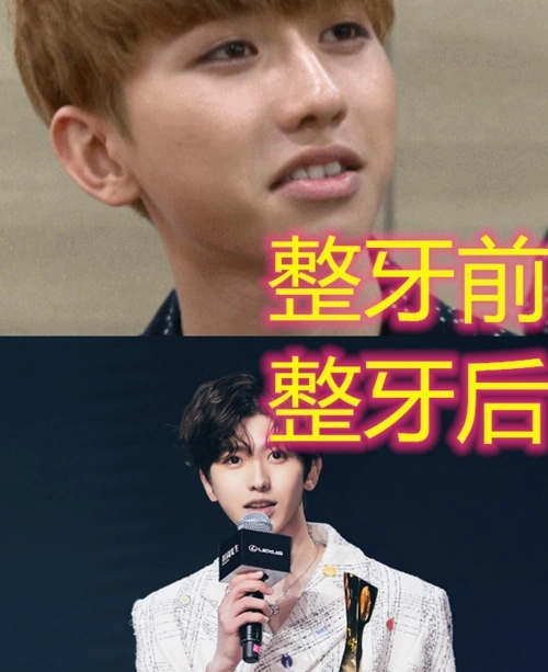 有种"整容"叫明星整牙,杨幂脸型变小,蔡徐坤变帅,而她终于逆袭!