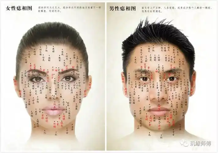 十处长痣, 一生不用愁, 这些地方的痣要留着!