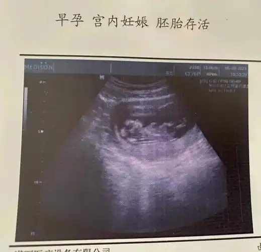 怀孕生产  碎碎念图1怀孕3个月图2出生第二天图3出生第50天首先恭喜