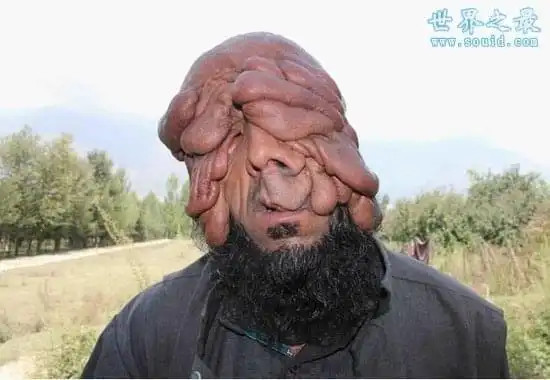 世界上最恶心的人,又丑又恶心的男人和女人(图片)_网易订阅