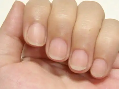 心脏不好看指甲图片,心脏不好大指甲图片-图片大观-奇异网