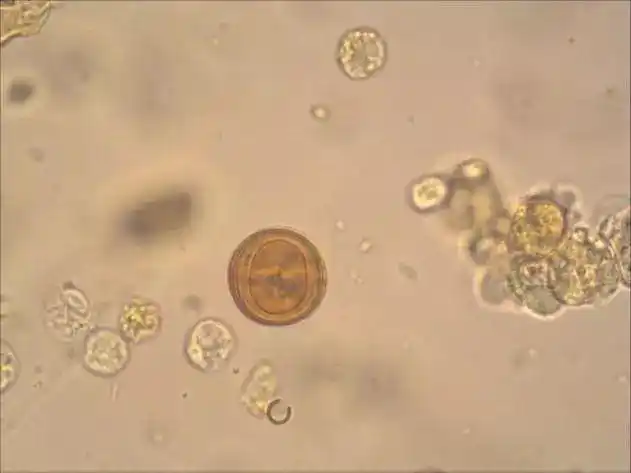 妖晶现形记第二季亮氨酸结晶