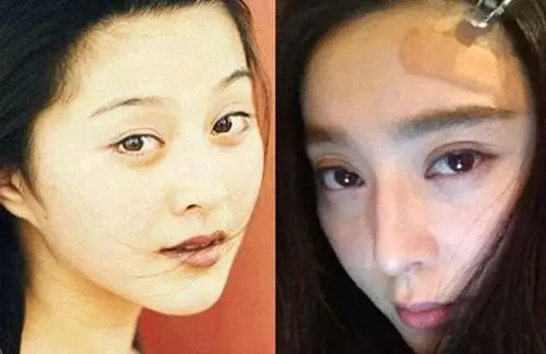 图范冰冰整容前后对比照虽有整容痕迹但网友承认还是底子好