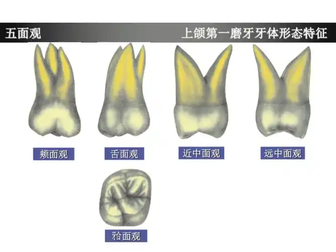 上颌第一磨牙牙体形态简述pptppt