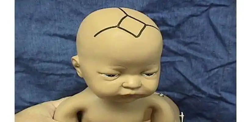 准妈必看的胎位图