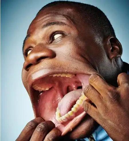 世界最大的嘴,可以轻松塞进去一罐可乐