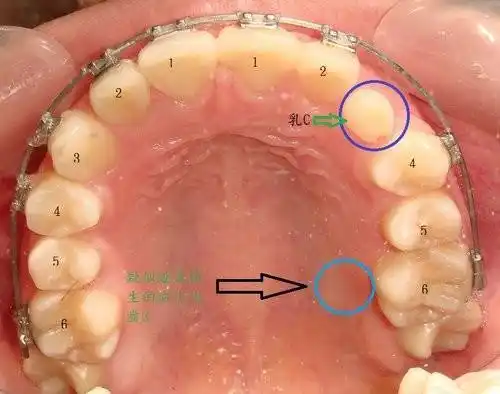 人的上颚有坑坑哇哇的褶皱是起什么作用的? - 知乎