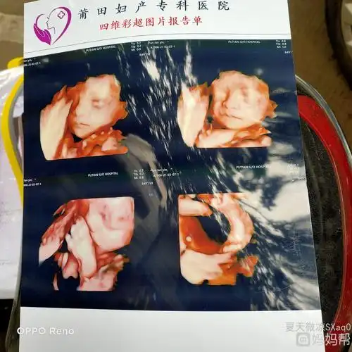 孕医通!四维彩超男女参照图对比"抛砖引玉"-第1张图片-华泰博客