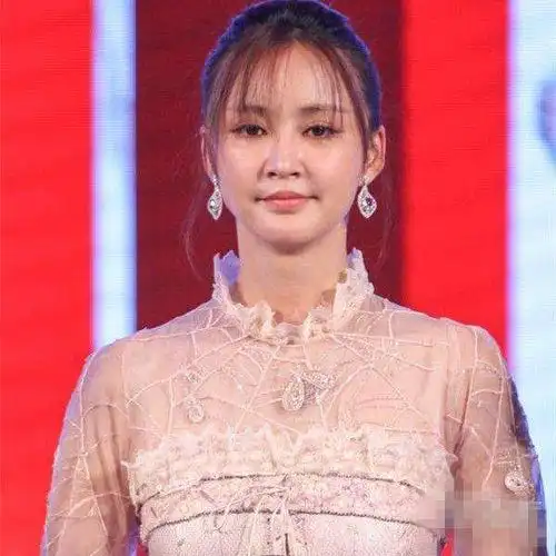 张歆艺4年换3个男人, 整容失败成这样 网友: 玻尿酸打太多