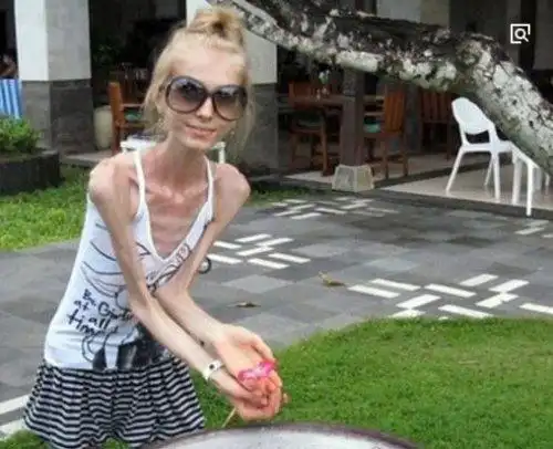 照片中的俄罗斯美女骨瘦如柴,仿佛轻轻一碰就会碎的感觉.