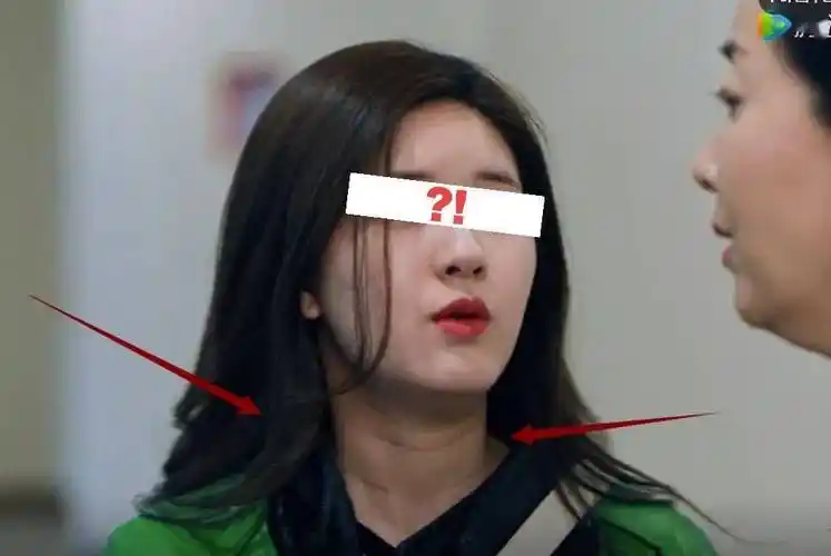 她的国民少女感被谁毁了?_赵露思_颈部_脖子