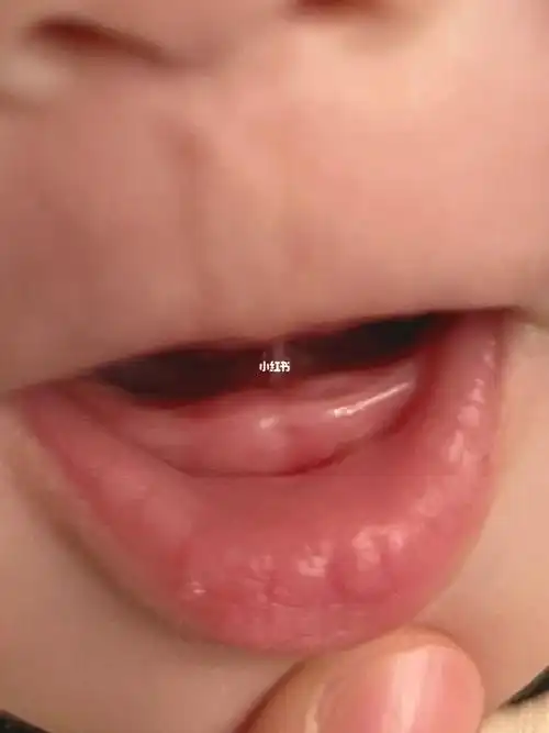 也没有饿的意思,今天突然发现下牙龈有两个凹槽,所以这是开始长牙了咩