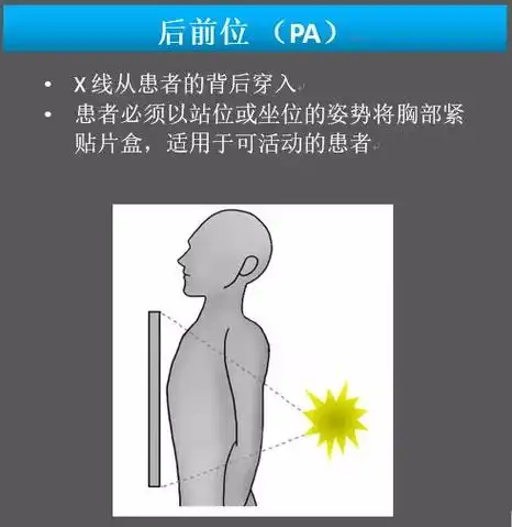 胸片拍摄方法主要有两种,后前位(图1)和前后位(图2).