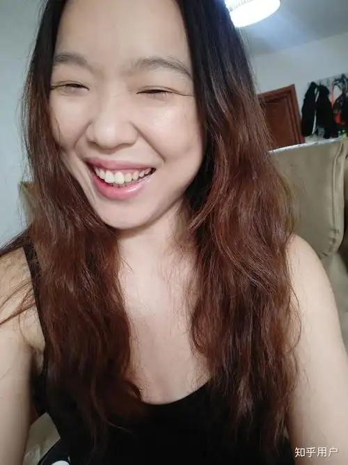 笑起来很丑是怎样一种体验