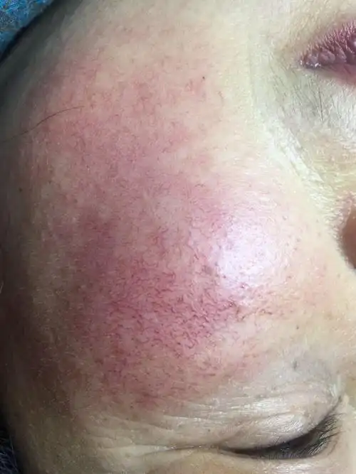 红血丝~女人心中永远都说不出的痛!