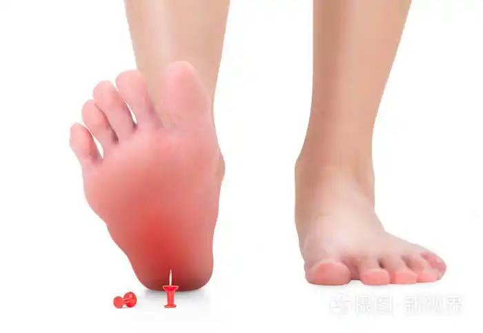 女性脚踩在红色图钉上的前视图意料之外的概念红色高光隔离在白色背景