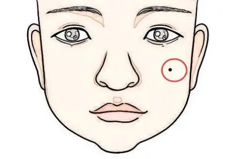 长在哪个部位的痣叫发财痣.