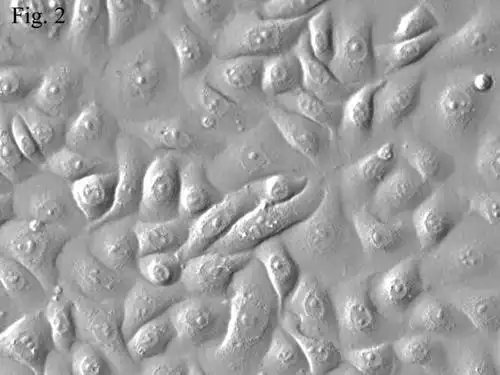 人表皮角质细胞胎儿