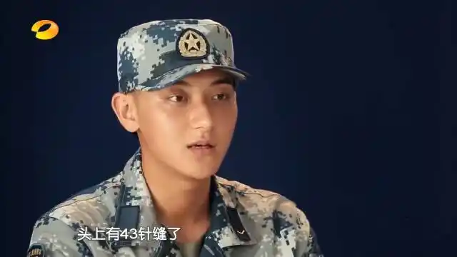 难怪黄子韬从来不理寸头,当他说出头上封了43针后,让人心疼