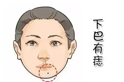 下巴有痣,财运亨通
