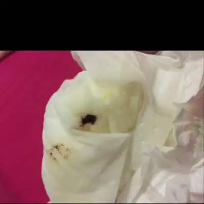 宝宝21天了,今天换纸尿裤上有一点红褐色的分泌物,麻烦大家帮忙看下是