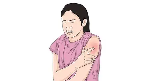 打完新冠疫苗胳膊疼怎么办