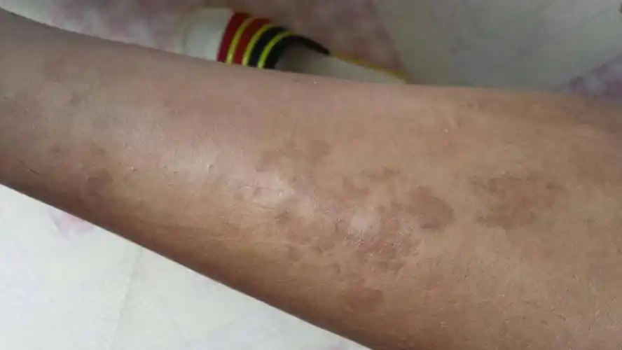 我小腿上是什么?