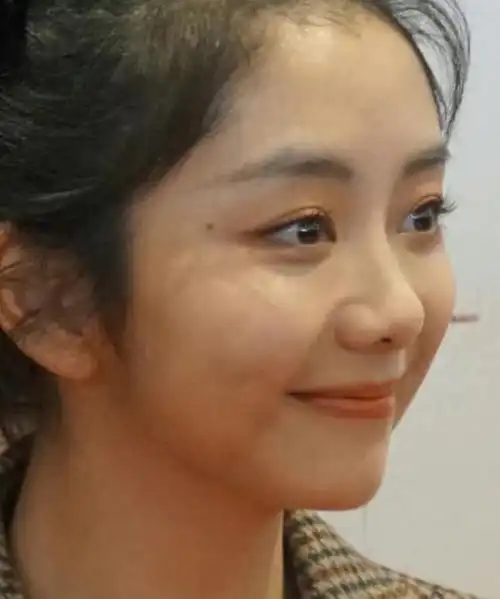 方形脸痘痘肌,内娱颜值天花板滤镜粉碎|迪丽热巴|杨幂|脸型|谭松韵