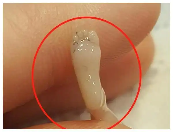 笑嘻嘻!胎儿图片"宝宝之家"-第1张图片-凯飞博客