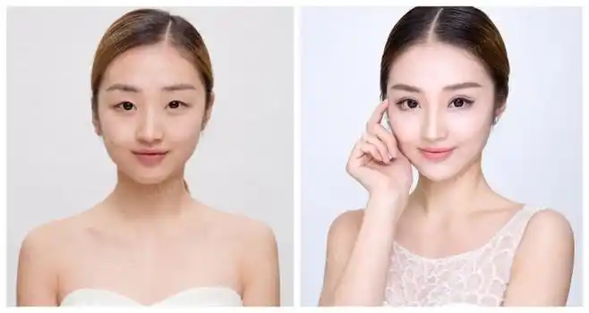 双眼皮真人案例新出炉的蜕变案例来啦从无神单眼皮到魅力大电眼效果就