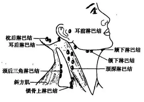 颈部淋巴结肿大拒保 淋巴结保险保不保