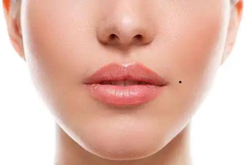 嘴巴左上角痣代表什么