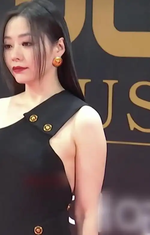 张靓颖瘦腿成功却忘了胳膊,穿无袖裙看"胳肢窝",被多余肉毁了