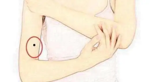 右手臂内侧有痣的女人 手臂长痣代表什么