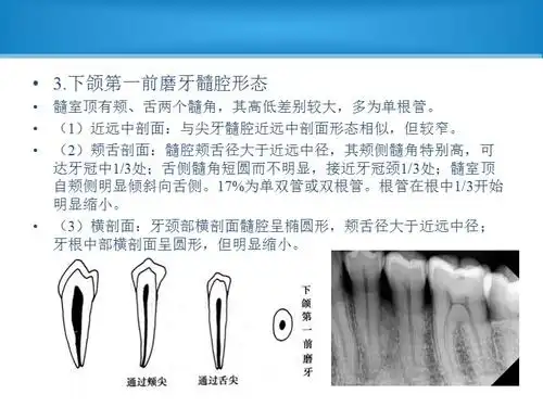 前磨牙及磨牙髓腔解剖.ppt