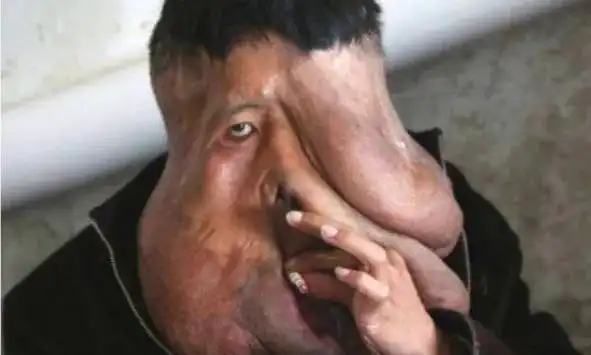 世界上最恶心的人 盘点世界上最丑最恶心的人