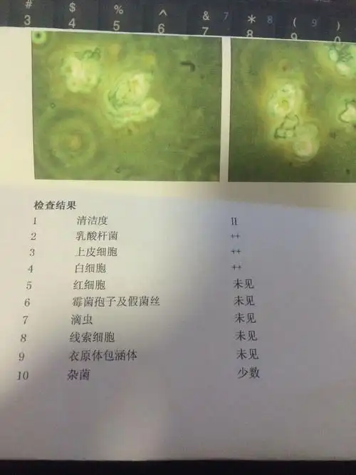 霉菌性阴道炎,白带常规检查有少数杂菌,还需用药吗?