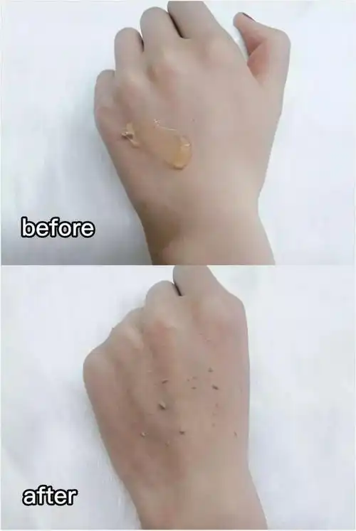 别让污垢塞满你的脸皮肤吸尘器吸出毛孔垃圾还你娇嫩婴儿肌