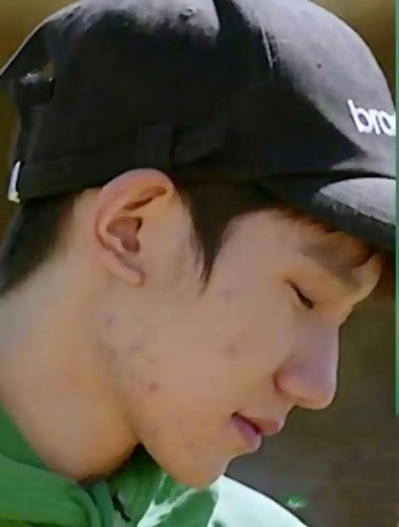 网友:王源的皮肤状态是明星该有的吗