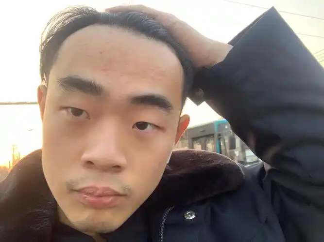 发际线很高的男人适合什么样的发型? - 知乎