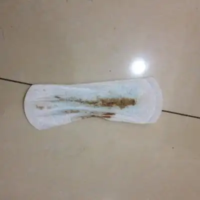 展开阅读全文 但我感觉好像是白带一样的东西,只是是咖啡色